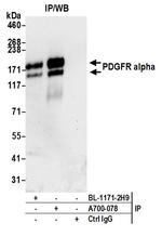 PDGFR alpha Antibody in Immunoprecipitation (IP)