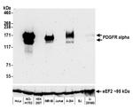 PDGFR alpha Antibody in Western Blot (WB)