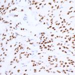 SOX10 Antibody in Immunohistochemistry (Paraffin) (IHC (P))