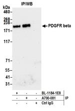 PDGFR beta Antibody in Immunoprecipitation (IP)