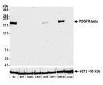 PDGFR beta Antibody in Western Blot (WB)