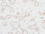 MED12 Antibody in Immunohistochemistry (Paraffin) (IHC (P))