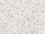 MED12 Antibody in Immunohistochemistry (Paraffin) (IHC (P))