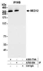 MED12 Antibody in Immunoprecipitation (IP)