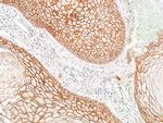 E-Cadherin Antibody in Immunohistochemistry (Paraffin) (IHC (P))