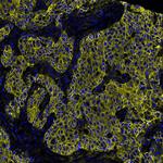 E-Cadherin Antibody in Immunohistochemistry (Paraffin) (IHC (P))