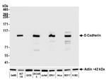 E-Cadherin Antibody in Western Blot (WB)