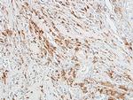 ALDH1A1 Antibody in Immunohistochemistry (Paraffin) (IHC (P))