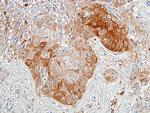 ALDH1A1 Antibody in Immunohistochemistry (Paraffin) (IHC (P))