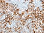 CEACAM1 Antibody in Immunohistochemistry (Paraffin) (IHC (P))