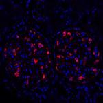 TJP1/ZO-1 Antibody in Immunohistochemistry (Paraffin) (IHC (P))