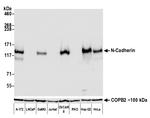 N-Cadherin Antibody in Western Blot (WB)