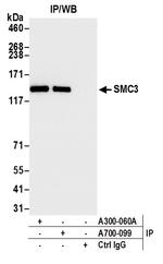 SMC3 Antibody in Immunoprecipitation (IP)