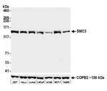 SMC3 Antibody in Western Blot (WB)