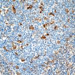 Vimentin Antibody in Immunohistochemistry (Paraffin) (IHC (P))