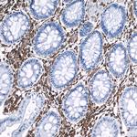 Vimentin Antibody in Immunohistochemistry (Paraffin) (IHC (P))