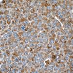 Vimentin Antibody in Immunohistochemistry (Paraffin) (IHC (P))