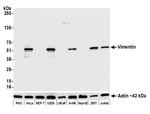 Vimentin Antibody in Western Blot (WB)