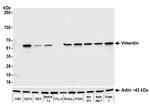 Vimentin Antibody in Western Blot (WB)