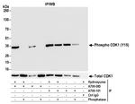 Phospho-CDK1 (Tyr15) Antibody in Immunoprecipitation (IP)