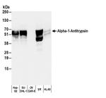 Human Alpha-1-Antitrypsin Antibody in Western Blot (WB)