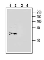 ACE2 (extracellular) Antibody in Western Blot (WB)