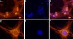 Adenosine A1 Receptor Antibody in Immunocytochemistry (ICC/IF)