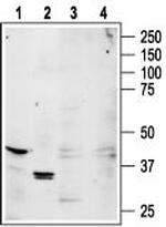 Adenosine A1 Receptor Antibody in Western Blot (WB)