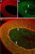 Angiotensin II Receptor Type-1 (extracellular) Antibody in Immunohistochemistry (IHC)