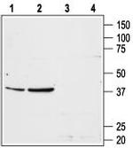 Angiotensin II Receptor Type-1 (extracellular) Antibody in Western Blot (WB)