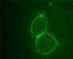 Angiotensin II Receptor Type-2 (extracellular) Antibody in Immunocytochemistry (ICC/IF)