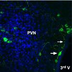 Angiotensin II Receptor Type-2 (extracellular) Antibody in Immunohistochemistry (Frozen) (IHC (F))