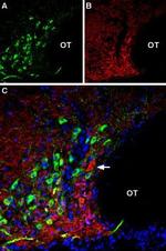 Angiotensin II Receptor Type-2 (extracellular) Antibody in Immunohistochemistry (Frozen) (IHC (F))