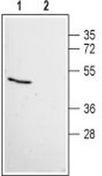 Angiotensin-(1-7) Mas Receptor Antibody in Western Blot (WB)