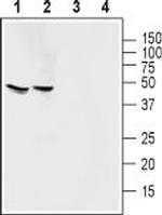 Angiotensin-(1-7) Mas Receptor Antibody in Western Blot (WB)