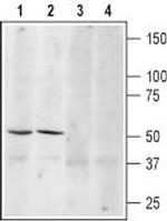 beta 3-Adrenergic Receptor (extracellular) Antibody in Western Blot (WB)