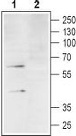 C3aR (extracellular) Antibody in Western Blot (WB)