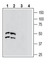 C5aR2 (extracellular) Antibody in Western Blot (WB)