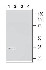 Adenosine A3 Receptor (extracellular) Antibody in Western Blot (WB)