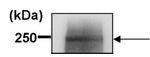 ABCA1 Antibody in Immunoprecipitation (IP)