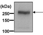 ABCA1 Antibody in Western Blot (WB)