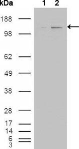 Abl2 Antibody in Western Blot (WB)