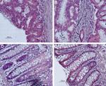 Bombesin Receptor 2 (GRPR) (extracellular) Antibody in Immunohistochemistry (Paraffin) (IHC (P))