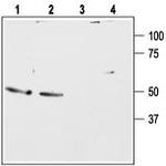 Bombesin Receptor 2 (GRPR) (extracellular) Antibody in Western Blot (WB)