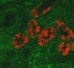 NGAL Antibody in Immunohistochemistry (Paraffin) (IHC (P))