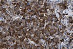 Leptin Antibody in Immunohistochemistry (IHC)