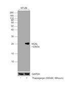 NGAL Antibody in Western Blot (WB)