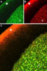 CaV1.2 (CACNA1C) Antibody in Immunohistochemistry (Paraffin) (IHC (P))