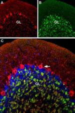 CaV1.2 (CACNA1C) Antibody in Immunohistochemistry (Paraffin) (IHC (P))