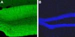 CaV1.2 (CACNA1C) Antibody in Immunohistochemistry (Paraffin) (IHC (P))